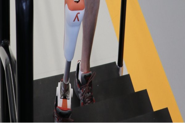 Robotic Prosthetics